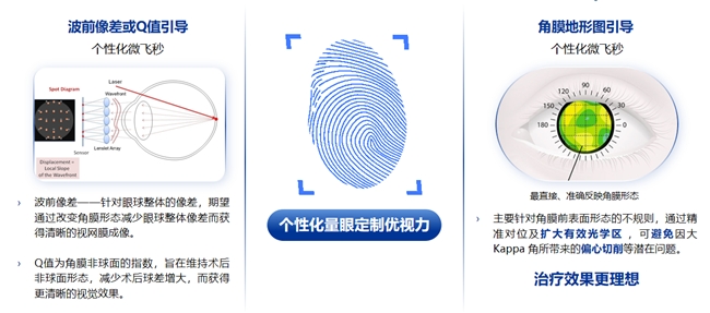 鄭州普瑞丨量眼定制獨一無二的清晰，個性化近視手術，為您提供極致的視覺體驗！(圖2)