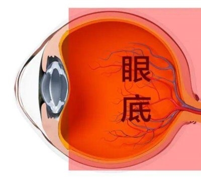 愛爾眼科：激光“打”在眼內還能治眼??？