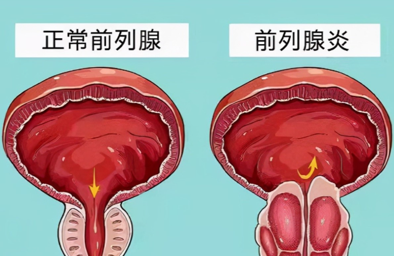 贛州現代泌尿?？漆t院好不好？專業醫療，呵護您的健康